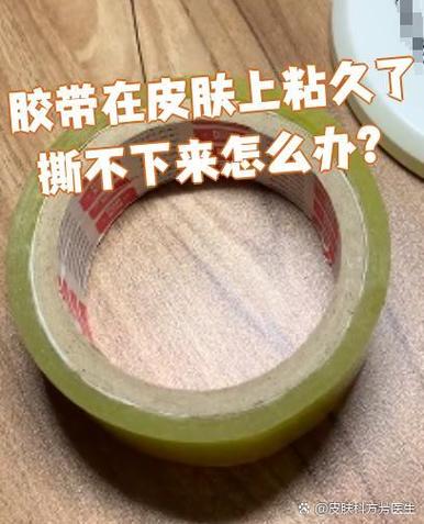 胶布粘上撕不下来怎么办