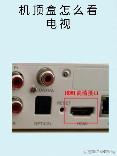 网线和电视机顶盒连接图解