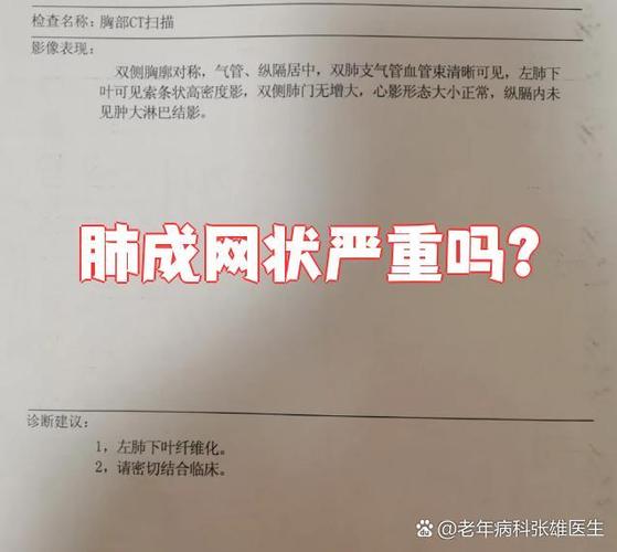 肺部网状是什么病