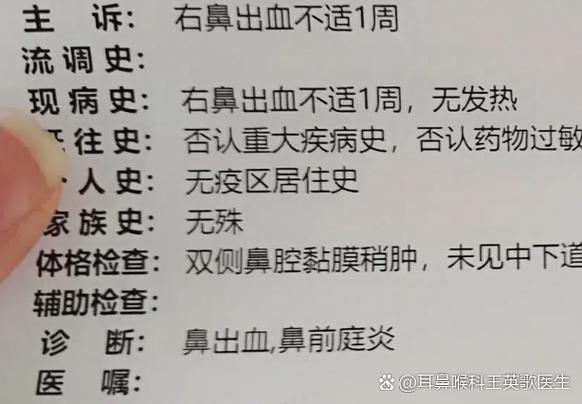 常流鼻血是怎么回事缩略图