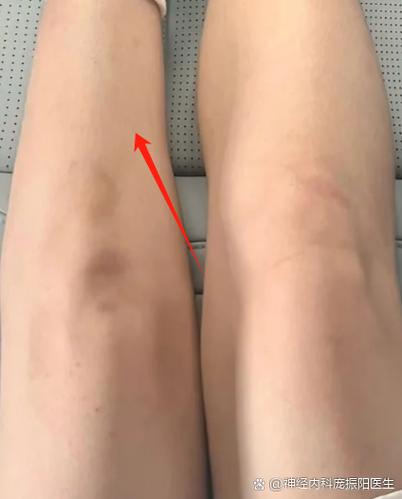 不走路的腿最新缩略图