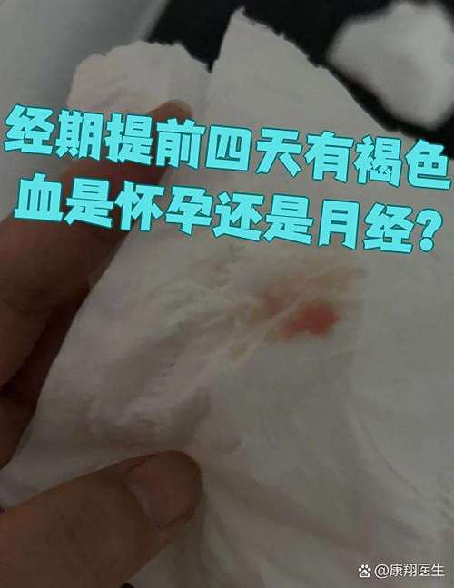 褐色的血是月经还是怀孕图标