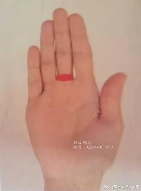 流鼻血绑中指原理