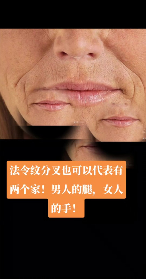 女人有福气的法令纹