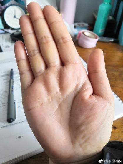 手掌三丘隆起的人多吗截图
