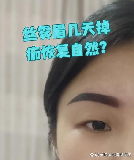 丝雾眉几天可以恢复自然