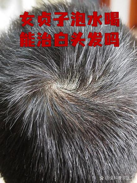 女贞子去除白发的方法