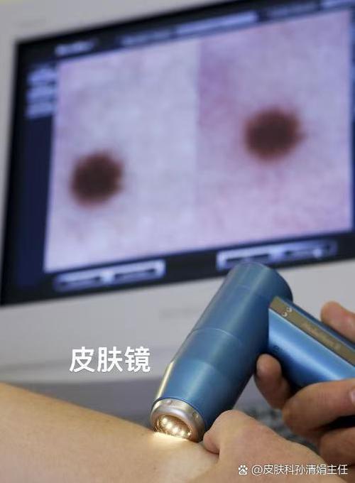 ipad屏幕白斑影响使用吗