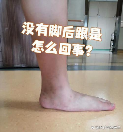 女性踝足脚丫子