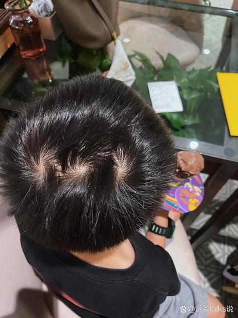 额头有璇男孩