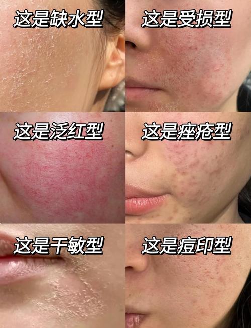 季节性脸过敏了应该注意什么游戏截图
