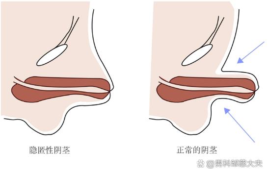 附近的人怎么删除这个功能缩略图