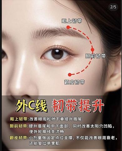 少女线多久能看出效果