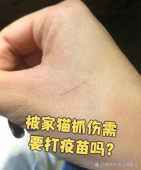 家猫接种过狂犬疫苗被挠