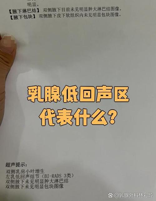 低回声区是什么意思啊