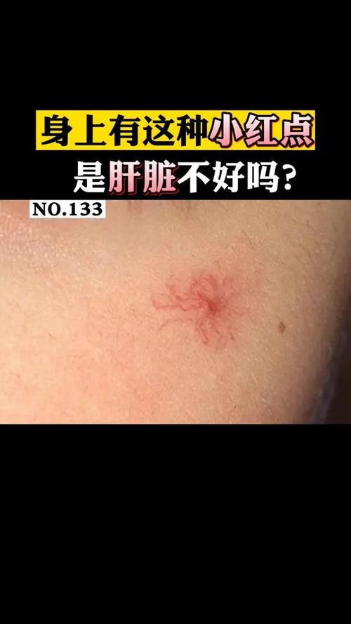 小红点按住就没有,松开就出现了
