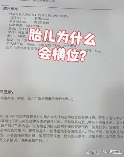 横位会自己转成头位吗