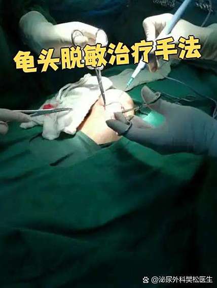 摩擦冠状沟能脱敏吗图标