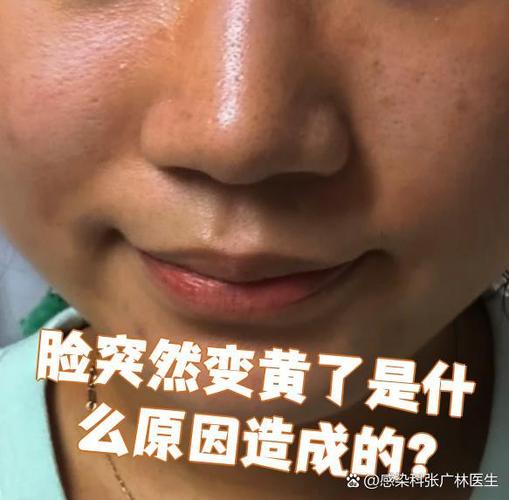手机照片拍出来脸很黄怎么回事截图