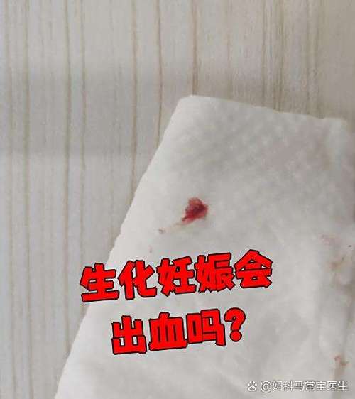 怀孕生化了主要什么原因引起的截图