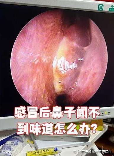 闻不到味道怎么快速解决