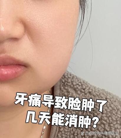 牙发炎脸肿了几天消肿