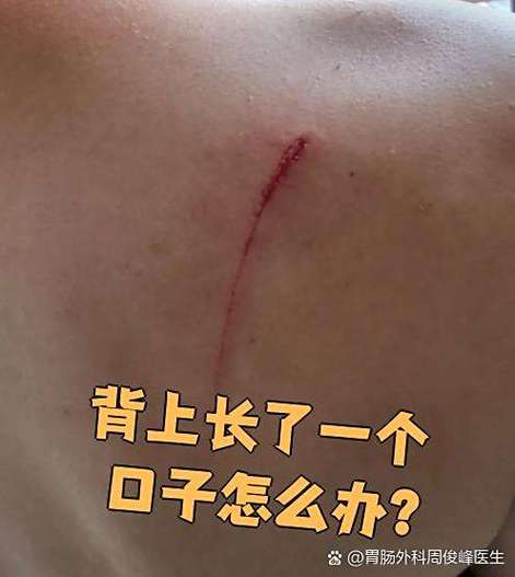 一什么口子