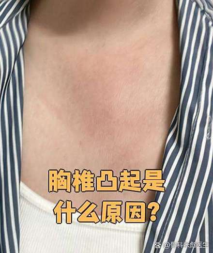 胸骨中间有个骨头凸起