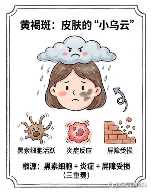 去除黑斑的最好方法