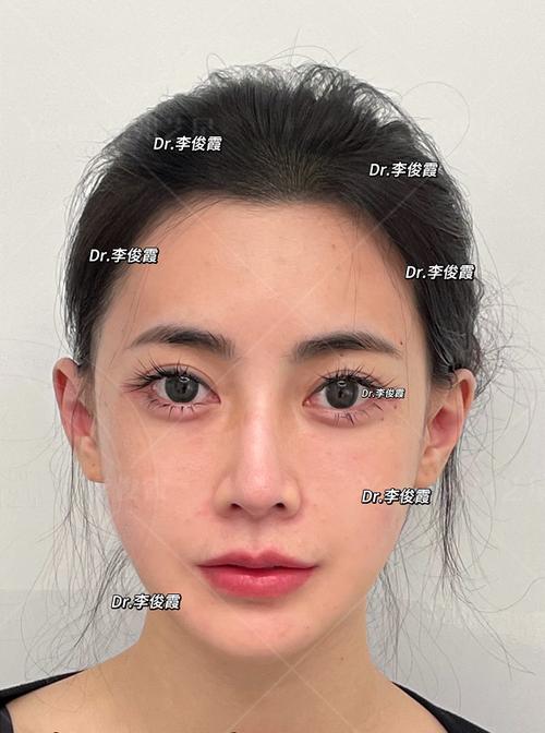 苹果面部识别移低一点图标