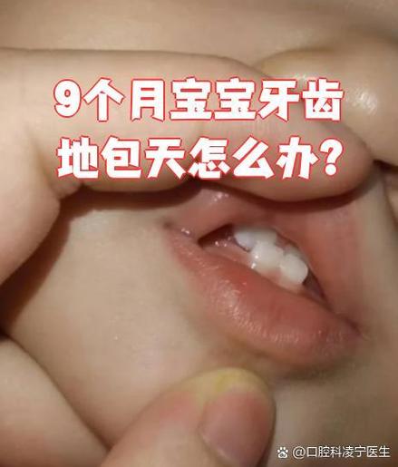 宝宝吸奶嘴会地包天吗