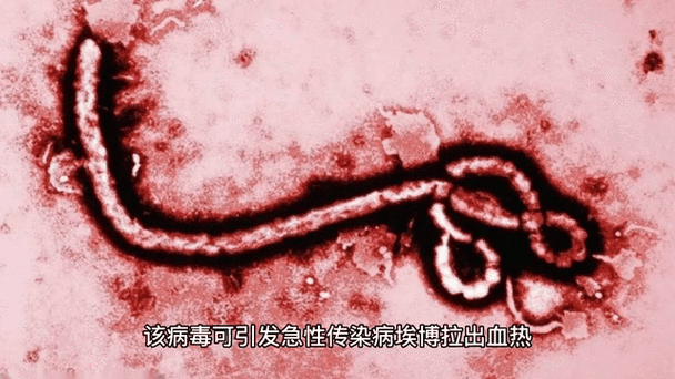 全球十大病毒排行榜