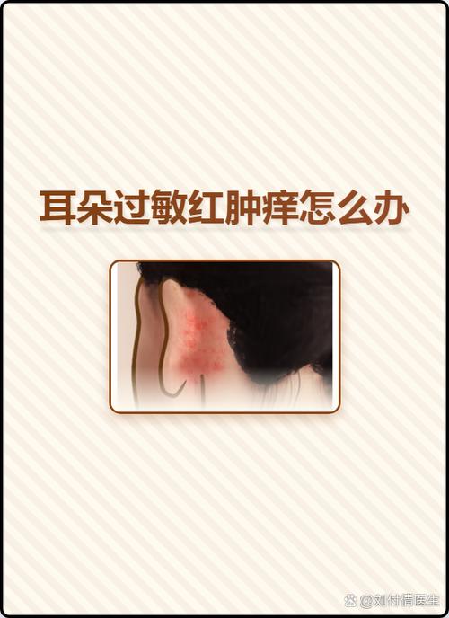 脚痒特别是晚上越抓越痒