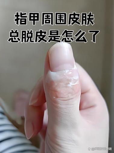 脱皮后多久恢复新皮