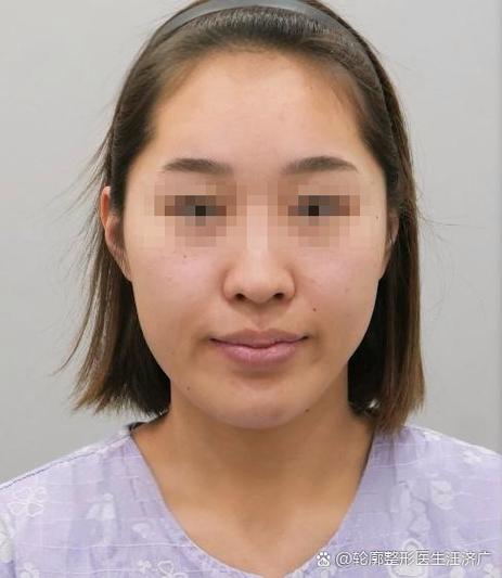 照片翻转后脸很歪
