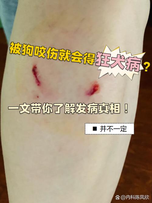狗血碰到人的伤口会有事吗