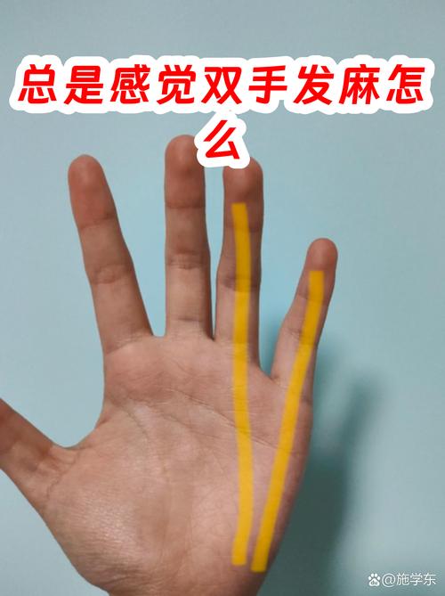 kill -10命令