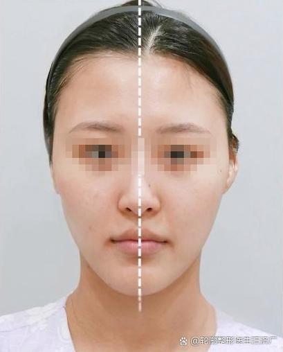 自拍镜像后发现脸超级不对称