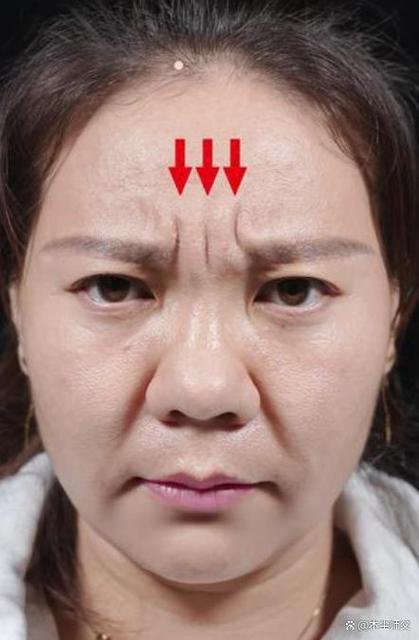 川字纹有什么影响