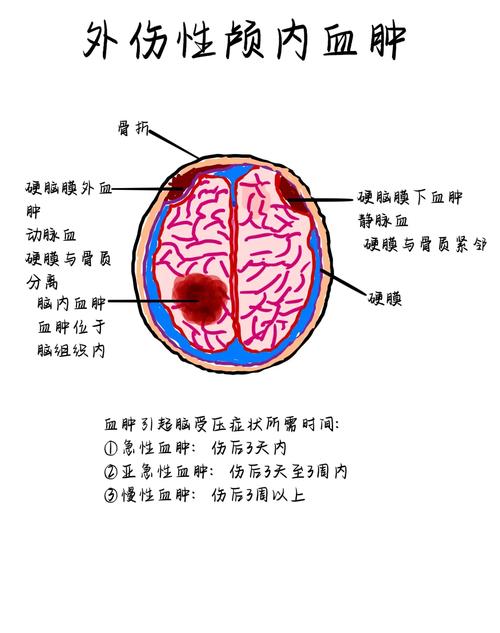 hematoma与bloodclot的区别