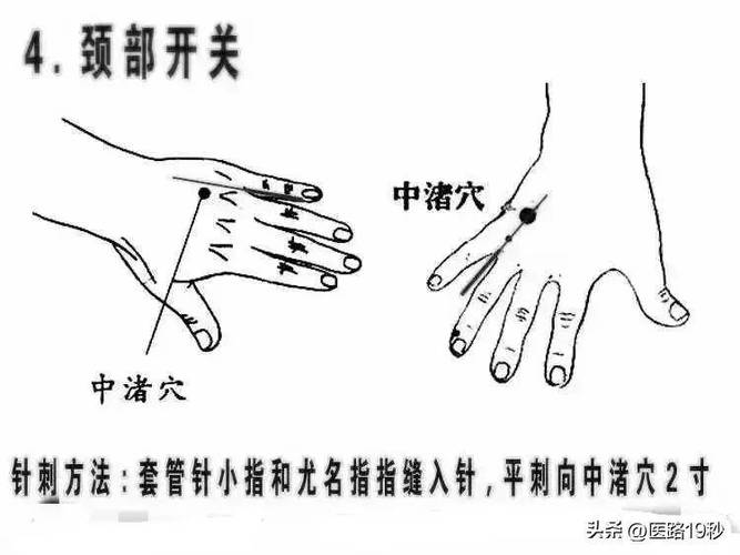 人体各种开关按钮在哪里?图截图