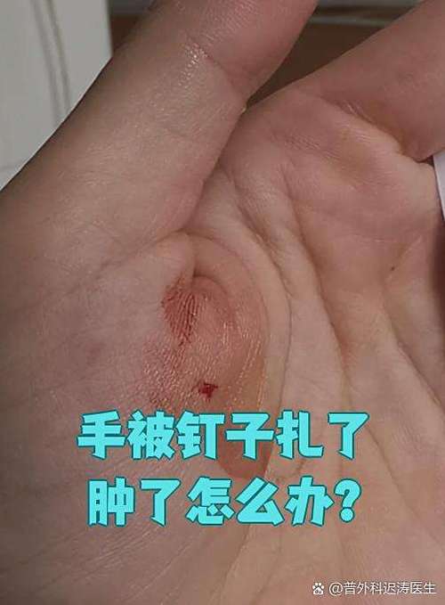 螺丝钉口被磨平怎么办截图