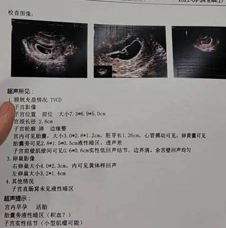 宫内暗区一周后没变化