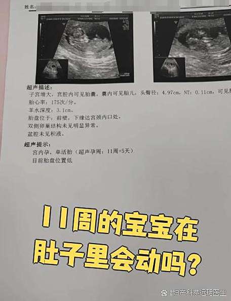 11周的胎儿有多大