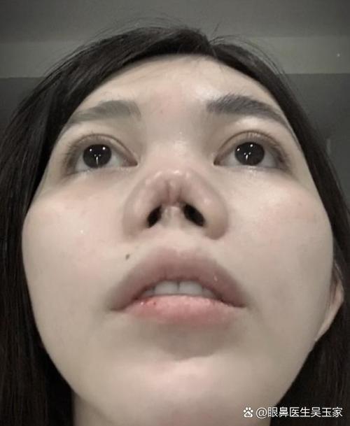 面容修复多少钱