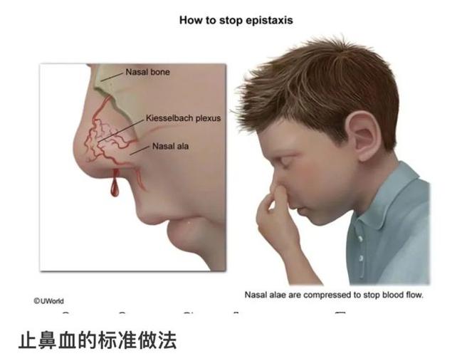 鼻血是人体哪里的血