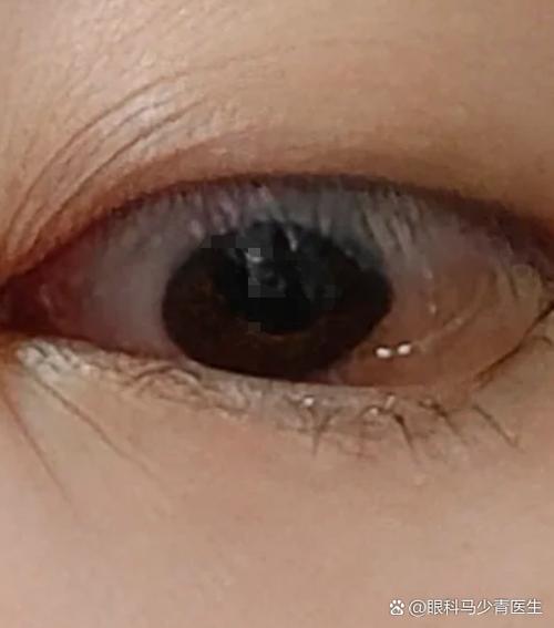 眼睛雾蒙蒙游戏截图