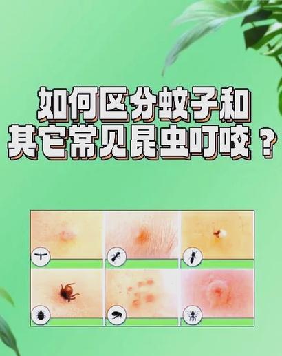 床上有虫子咬人很痒怎么办怎样消灭