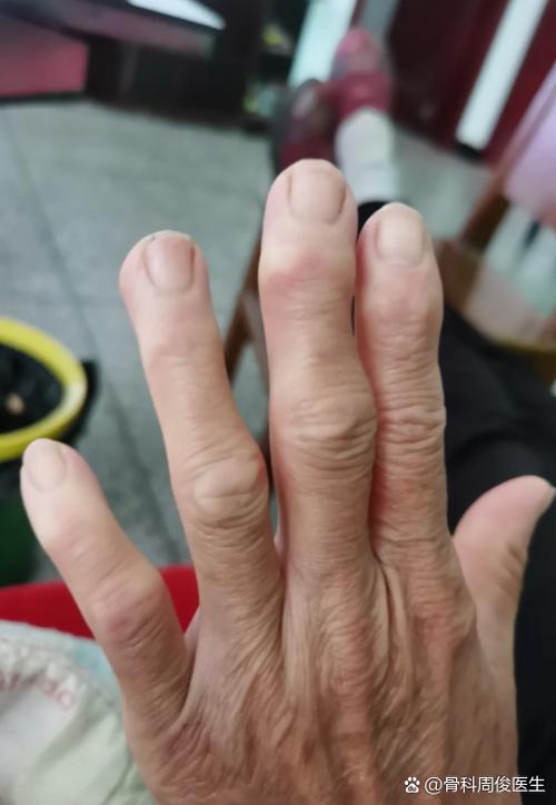 手指变形图片截图