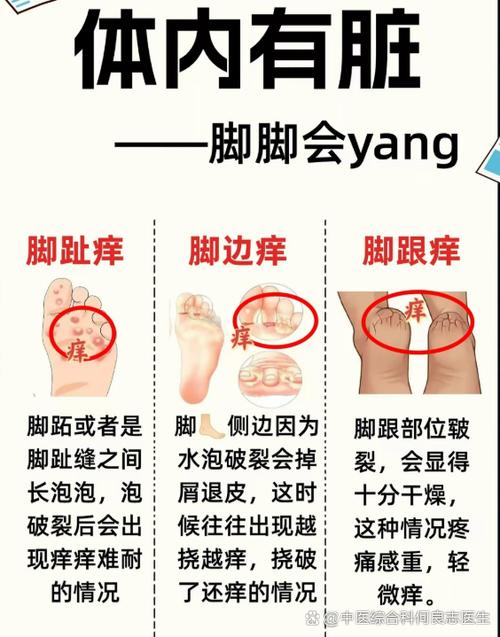 脚底板痒是什么原因